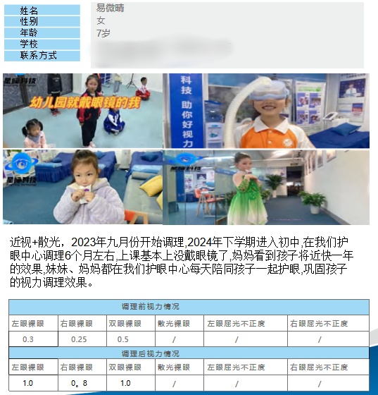 近视+散光视力调理